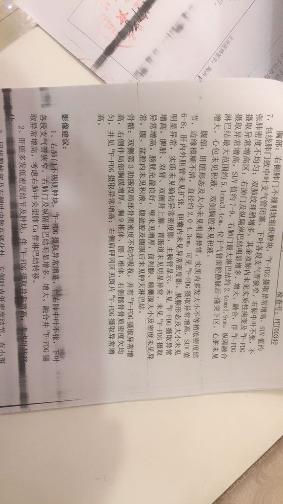 我父亲刚确诊了小细胞肺癌晚期肝淋巴骨转移