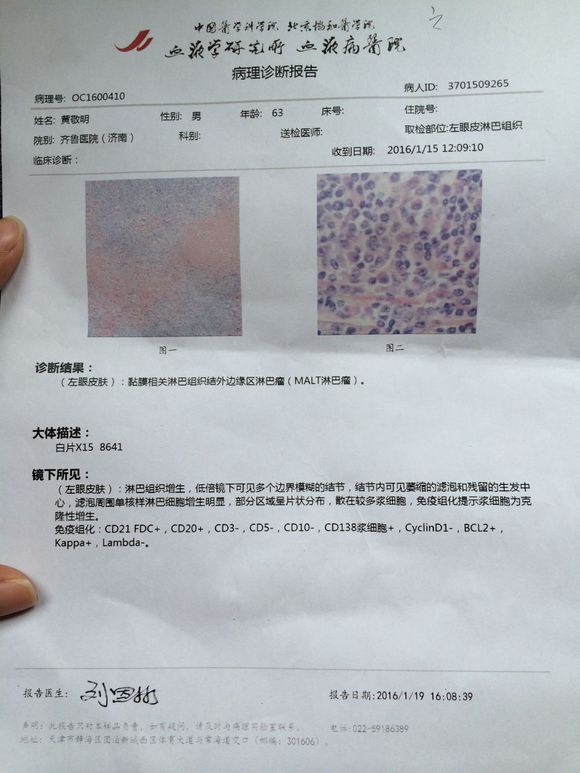 免疫组化结果出来了，malt淋巴瘤，大家帮忙看看吧