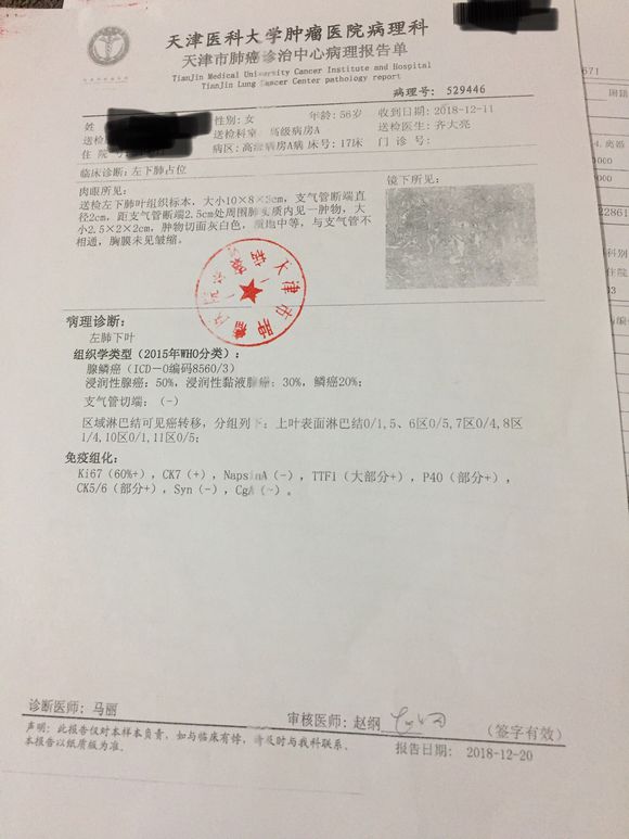 老娘的病理报告出来了。好像不太好！哪位大神懂帮我看看