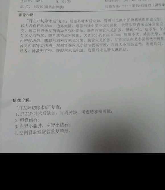 肝癌转淋巴有什么好办法吗，还有生存期怎么样
