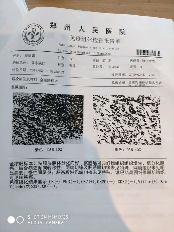这是病历及术后病理报告，懂得人帮忙看看