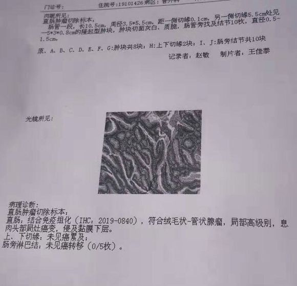 肠镜提示ca，活检病理显示高级别瘤变