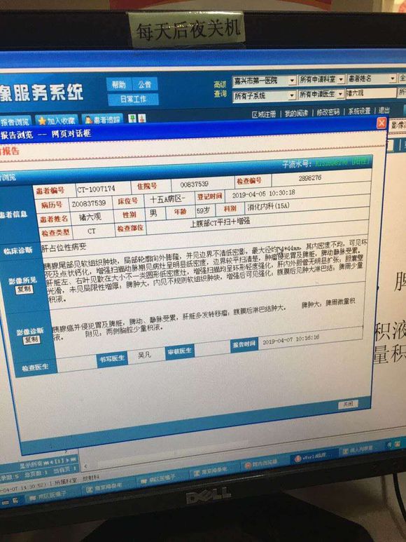 我爸是不是时间不多了