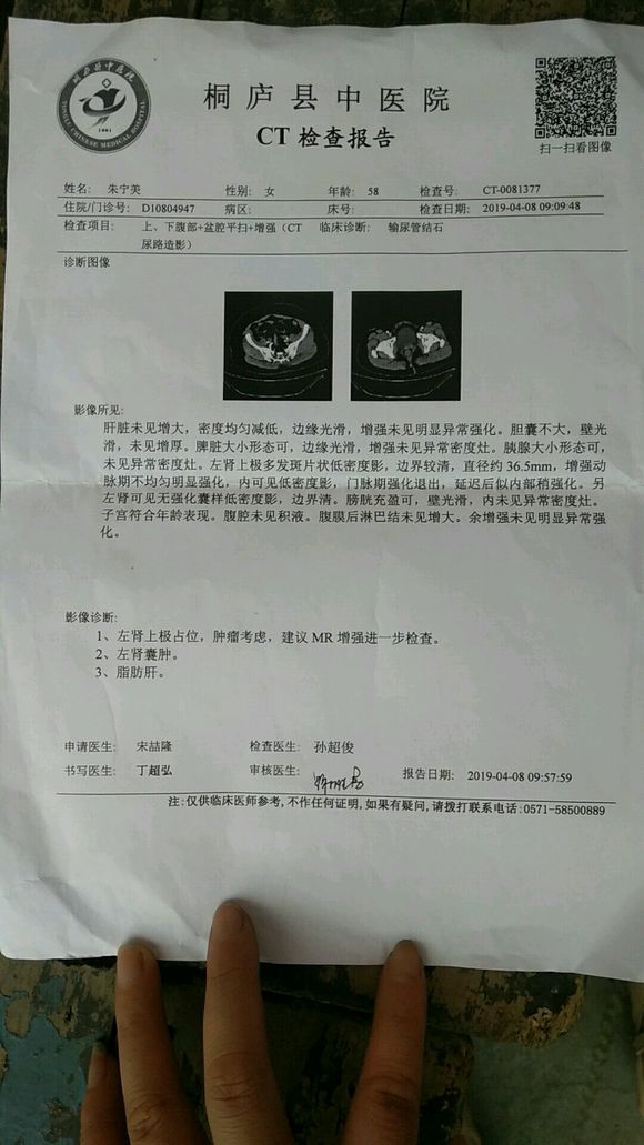 肾肿瘤，肺部有结节