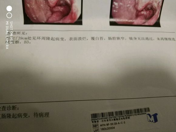 爷爷70岁了，还能做手术吗?这个算早期还是晚期呀?